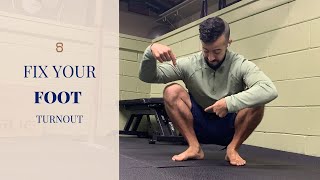 How to Fix Your Foot Turnout Tibial Torsion or Rotation [upl. by Oika]