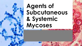 Basic Mycology 03 SUBCUTANEOUS amp SYSTEMIC MYCOSES Mahon 7th ed [upl. by Desiree952]