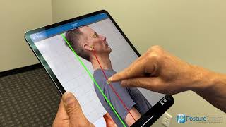 PostureScreen Augmented Reality Assessments  4 View Tutorial [upl. by Weihs]