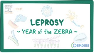 Leprosy Year of the Zebra [upl. by Kotz]