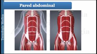 Radiologia Para Estudiantes TC de pared abdominal [upl. by Ambrosius]