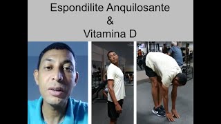 Selmo  Espondilite Anquilosante 917 [upl. by Wake]