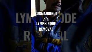 ENLARGED SUBMANDIBULAR LYMPH NODE REMOVAL [upl. by Jemine159]