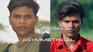 Correct Facial Asymmetry Exercises Causes and Effective Solutions for a Symmetrical Face [upl. by Liederman981]