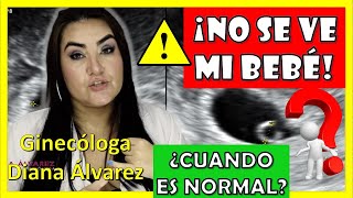 ⚠SACO GESTACIONAL SIN BEBÉ❗ ¿Hasta cuando es NORMAL❓ por GINECOLOGA DIANA ALVAREZ [upl. by Placido936]