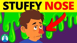 7 Ways to Clear a Stuffy Nose Nose Unblocking Techniques [upl. by Urbannal]