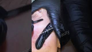 dermaplaningfacial reels dermalogicaexpert viralvideos skincare dermaplaning glowingskin [upl. by Gneh]