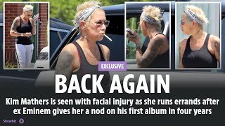 News BACK AGAIN Kim Mathers is seen with facial injury as she runs errands after ex Eminem gives [upl. by Gerianne]