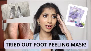 Trying Out the Foot Peeling Mask  Did It Work  Urvee [upl. by Akimehs]