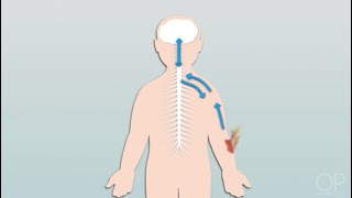 Pathophysiology of Pain by C Dowling  OPENPediatrics [upl. by Solotsopa]