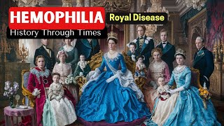 Hemophilia A royal disease History Through times Talmud and Bible [upl. by Geirk531]