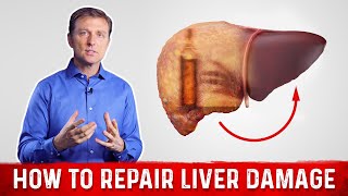 How To Repair Liver Damage After Alcohol – DrBerg on Liver Cirrhosis [upl. by Riordan629]