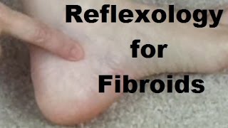 Reflexology for Fibroids  Massage Monday 274 [upl. by Aja]