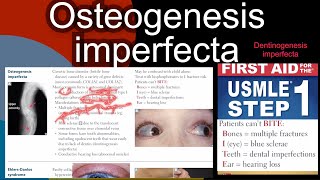 Osteogenesis imperfecta  Dentinogenesis imperfecta in HindiUrdu by first aid for USMLE step 1 [upl. by Diana]