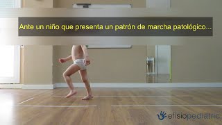 ¿Qué hacemos ante un niño que presenta un patrón de marcha patológico [upl. by Graces]