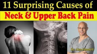 11 Surprising Causes of Neck amp Upper Back Pain  Dr Alan Mandell DC [upl. by Cathryn]