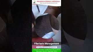 Filariasis managementayurvedapanchakarmaayurvedicmedicine natural doctor [upl. by Eidas]