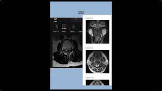 RADIOLOGY EXAM CASES [upl. by Ycak]