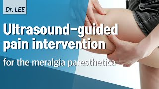 TAnatomy and US guided pain intervention for the meralgia paresthetica PRF treatement [upl. by Ailen]