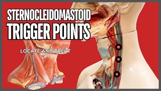 Understanding Trigger Points in the Sternocleidomastoid Muscle [upl. by Yna]