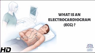 What Is An Electrocardiogram [upl. by Atirys]