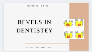 BEVELS IN DENTISTRY [upl. by Morry]