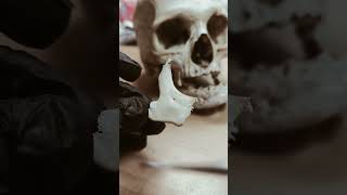 ZYGOMATIC BONE [upl. by Oos]