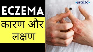 Eczema एक्जिमा Causes Symptoms amp Types  Atopic amp Seborrheic Dermatitis Symptoms Hindi Practo [upl. by Sherie]