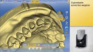 Sirona inEos X5 Scanning process  Сканирование лабораторным сканером Sirona inEos X5 [upl. by Rogovy]