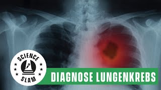 Diagnose Lungenkrebs Was passiert danach Asmae Gassa – Science Slam [upl. by Nsaj202]