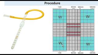 Total WBC counting by using hemocytometer  Neubaurs Chamber  urduhindi [upl. by Zorana550]