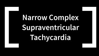 Narrow Complex Supraventricular Tachycardia [upl. by Prober]