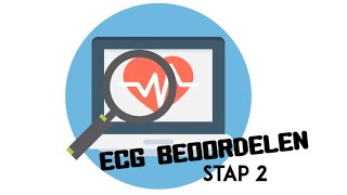 ECG Beoordelen  stap 2 Geleidingstijden [upl. by Rehttam716]