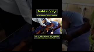 Brudzinskis sign a physical exam to test meningitis [upl. by Kant]