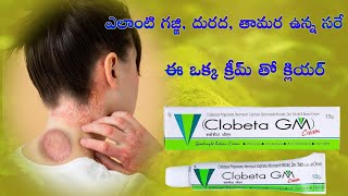 Clobeta GM cream uses in telugu  anti bacterial cream  antifungal cream  skin infection [upl. by Annayek666]