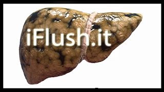 ♥ ♥ ♥ FATTY LIVER DIET RECIPES ♥ ♥ ♥ Quick amp Easy ♥ Liver Detox ♥ Snack Recipe [upl. by Arrait]