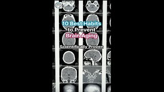 10 Best Habits to Prevent Brain Aging brainaging brainhealth antiaging [upl. by Christianna]