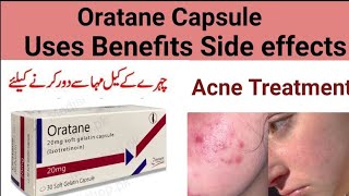 oratane capsule uses in Urdu hindi l Isotretinoin use side effects [upl. by Suzette]