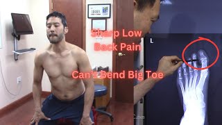 Actor Jun with Sharp Low Back Pain and Cant Bend Big Toe [upl. by Salkcin109]