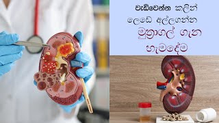 මූත්‍රා ගල් ඇතිවීම ලක්ශණ  wakugaduwe gal  muthra gal  Kidney Stone signs amp Symptoms [upl. by Nosylla]