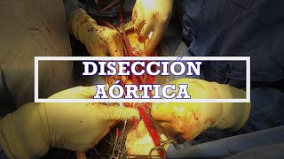 Disección Aórtica  Parte 1 [upl. by Johannes]