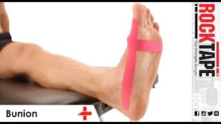 RockTape  Kinesiology Tape Instruction  Bunion [upl. by Scheider]