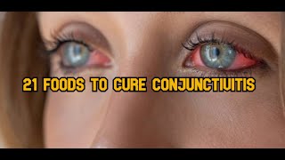 21 Foods to cure conjunctivitis [upl. by Dayle]