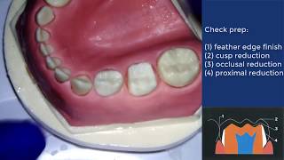 Conventional crown preparation for PMC  Institute of Dentistry QMUL [upl. by Nnylesor]