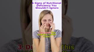 6 Signs of Nutritional Deficiency You Shouldnt Ignore HealthTips Nutrition healthyliving [upl. by Ialda814]