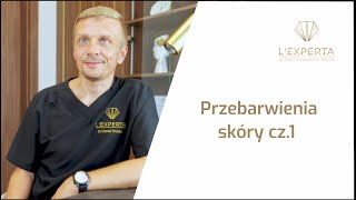 Przebarwienia  poznaj ich rodzaje  LExperta [upl. by Emoraj248]