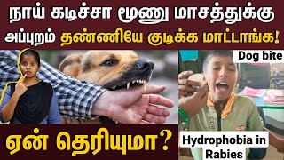 நாய் கடிச்சா நாய் மாதிரி குரைப்பாங்களா  Everything you should know about Rabies  Rabies symptoms [upl. by Eidas]