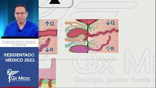 Obstetricia  5 Estados Hipertensivos [upl. by Nytsirc248]