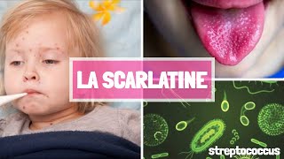 LA SCARLATINE [upl. by Carolin]