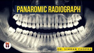 Panoramic Radiography l Focal Trough in Panoramic Radiography l Extraoral Radiography l OPG [upl. by Broeder135]